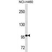 Transducin Like Enhancer Of Split 4 (TLE4) Antibody