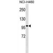 Transducin Like Enhancer Of Split 4 (TLE4) Antibody