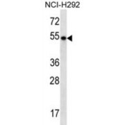 TBC1 Domain Family Member 3E (TBC1D3E) Antibody