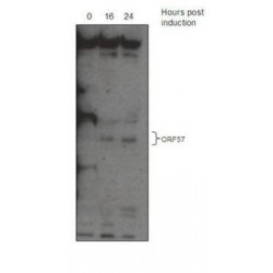 KSHV ORF 57 Antibody