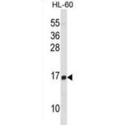 Histone H2B Type 1-D (HIST1H2BD) Antibody