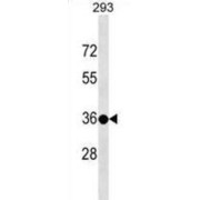 Testis-Specific Y-Encoded Protein 3 (TSPY3) Antibody