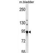 Neutral Ceramidase (ASAH2) Antibody