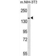 Receptor Tyrosine-Protein Kinase ErbB-4 (HER4) Antibody