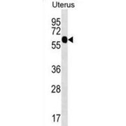 ZFP64 Zinc Finger Protein (ZFP64) Antibody