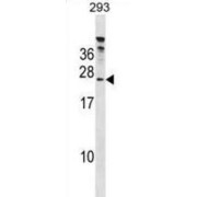 HIV TAT Specific Factor 1 (HTATSF1) Antibody