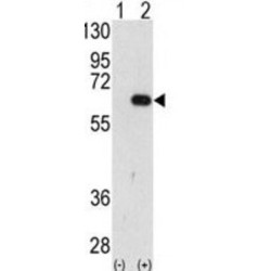 E3 Ubiquitin-Protein Ligase AMFR (AMFR) Antibody