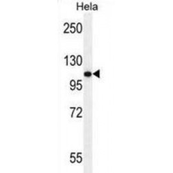 Androgen Receptor (AR) Antibody