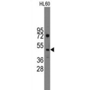 Indian Hedgehog Protein (IHH) Antibody