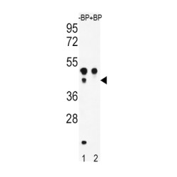 Cyclic AMP-Dependent Transcription Factor ATF-4 (ATF4) Antibody