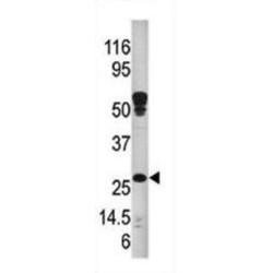 Amyloid B-Peptide-Binding Alcohol Dehydrogenase (ABAD) Antibody