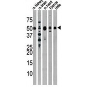 Parkin Antibody