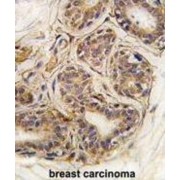 Cancer Susceptibility 3 (CASC3) Antibody