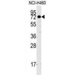 Cancer Susceptibility 3 (CASC3) Antibody