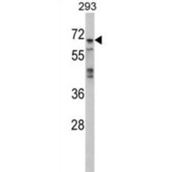 Mitogen-Activated Protein Kinase 4 / ERK4 (MAPK4) Antibody