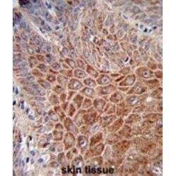 Immunoglobulin Heavy Constant Alpha 1 (IGHA1) Antibody