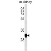 Glucosamine-6-Phosphate Deaminase 1 (GNPDA1) Antibody