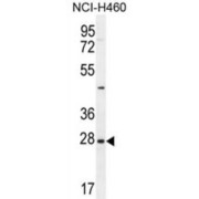 Endothelin 3 (EDN3) Antibody