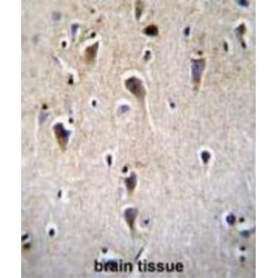 Corticotropin-Releasing Factor Receptor 2 (CRFR2D) Antibody