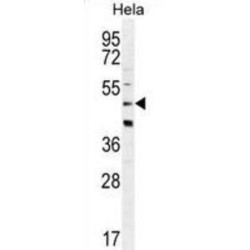 Corticotropin-Releasing Factor Receptor 2 (CRFR2D) Antibody