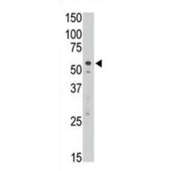 Sialic Acid Binding Ig Like Lectin 7 (SIGLEC7) Antibody