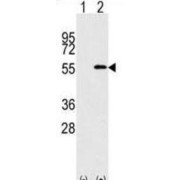 Nucleoporin 50 (NUP50) Antibody