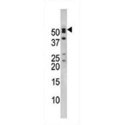 Nucleoporin 50 (NUP50) Antibody