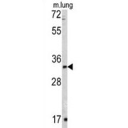 RNA Exonuclease 1 Homolog (Rex1) Antibody