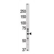 E3 Ubiquitin-Protein Ligase Synoviolin (SYVN1) Antibody