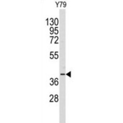 Aldo-Keto Reductase Family 1 Member A1 (AKR1A1) Antibody