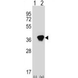 Aldo-Keto Reductase Family 1 Member A1 (AKR1A1) Antibody