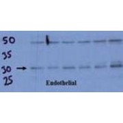 Down Syndrome Critical Region Protein 1 (DSCR1) Antibody