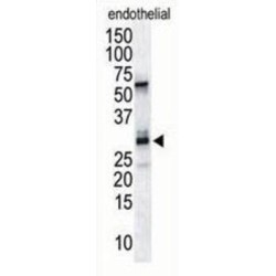 Down Syndrome Critical Region Protein 1 (DSCR1) Antibody