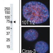 Ribosomal Protein S6 Kinase Alpha-4 (RPS6KA4) Antibody