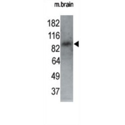 Serine/Threonine-Protein Kinase MARK1 (MARK1) Antibody