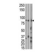 Serine/Threonine-Protein Kinase MARK1 (MARK1) Antibody