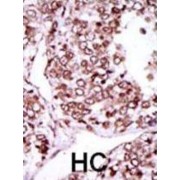 Calcium/calmodulin-Dependent Protein Kinase Type II Subunit Gamma (CAMK2G) Antibody