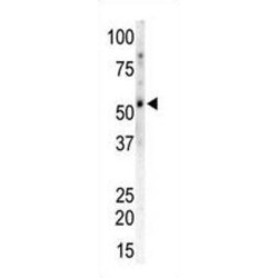 Calcium/calmodulin-Dependent Protein Kinase Type II Subunit Gamma (CAMK2G) Antibody