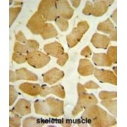 Sphingosine Kinase 1 (SPHK1) Antibody