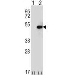 Sphingosine Kinase 1 (SPHK1) Antibody