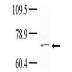 Tyrosine Kinase Non Receptor 1 (TNK1) Antibody