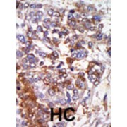 cGKI Antibody