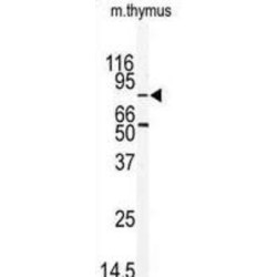 Serine/Threonine-Protein Kinase MARK2 (MARK2) Antibody
