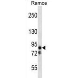 Serine/Threonine-Protein Kinase MARK2 (MARK2) Antibody