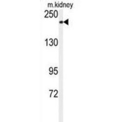 Transient Receptor Potential Cation Channel Subfamily M Member 7 (TRPM7) Antibody