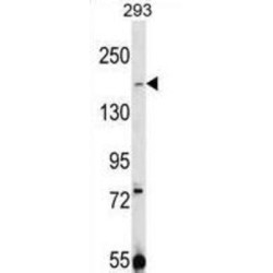 Transient Receptor Potential Cation Channel Subfamily M Member 7 (TRPM7) Antibody