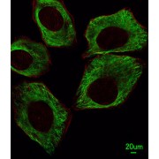 Tubulin Beta (TUBB) Antibody