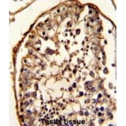 Tubulin Beta (TUBB) Antibody