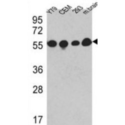 Tubulin Beta (TUBB) Antibody