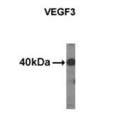 Vascular Endothelial Growth Factor C (VEGFC) Antibody